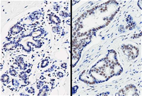 Protein That Represses Critical Checkpoint Protein For Cellular Growth