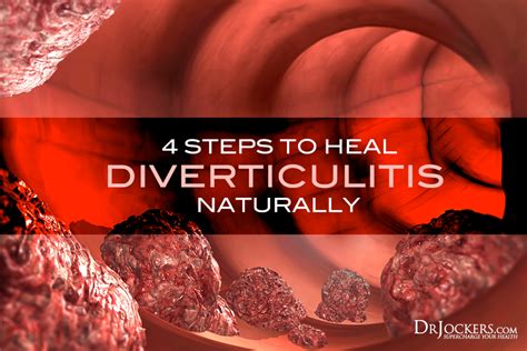 4 Steps To Heal Diverticulitis Naturally Diverticulitis