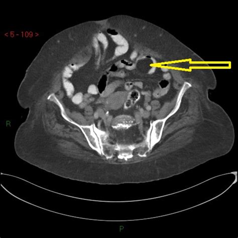 Image Radiopaedia Org