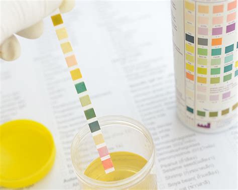 Complete Urinalysis In Calgary Tests Integrative Health