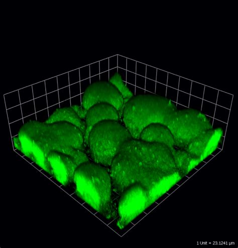 Pseudomonas Aeruginosa Biofilm