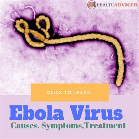 Ebola Virus Disease Causes Picture Symptoms And Treatment