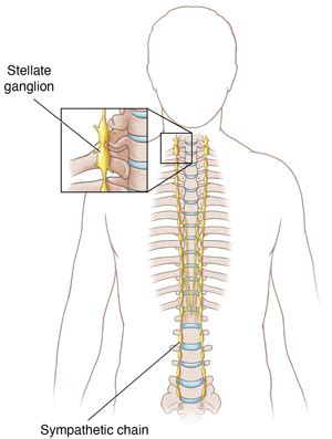 Sympathetic Nerve Block | Saint Luke's Health System