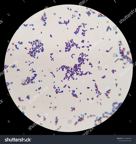 Стоковая фотография 1319269289 Bacteria Gram Staining Under