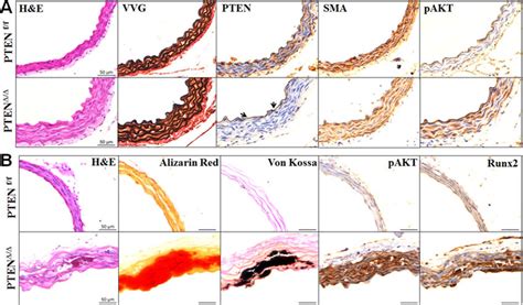 Smc Specific Pten Deletion Promotes Ex Vivo Aortic Calcification A Download Scientific Diagram