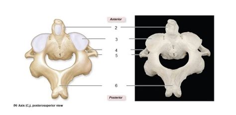 Axis Vertebra Flashcards Quizlet