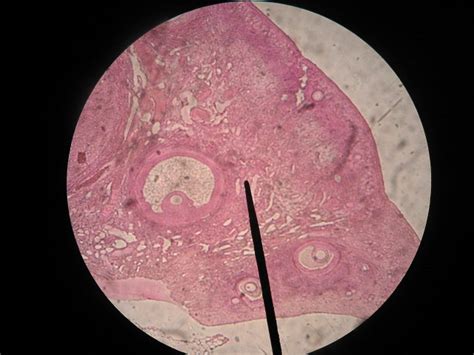 Ovary Corpus Luteum Right Portion Of Slide M Wheeless Flickr