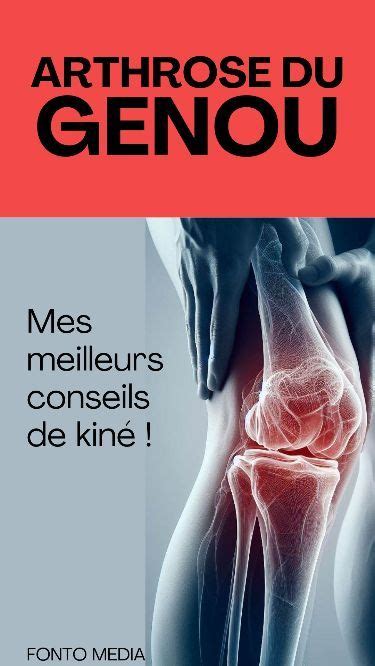 Vous avez de l arthrose du genou gonarthrose ou vous appréhendez d