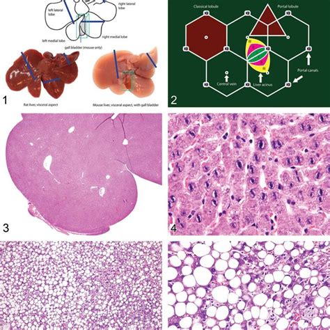 -Mouse liver. Hepatic atrophy. FIGURE 44.-Mouse liver. Cytoplasmic ...