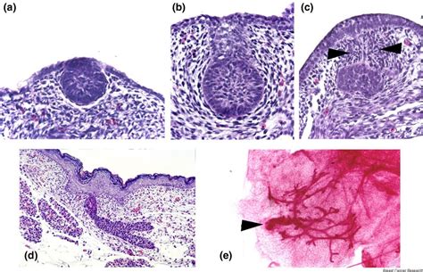 Key Stages Of Mammary Gland Development Molecular Mechanisms Involved