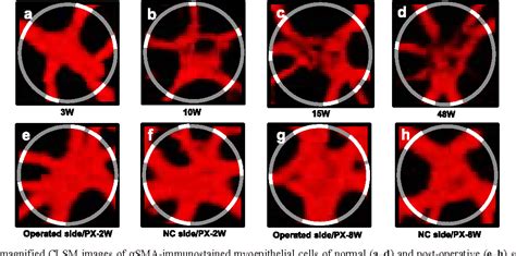 Figure 10 From Morphological Changes Of Myoepithelial Cells In The Rat