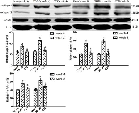 Western Blotting Analyses Of A Sma Collagen I And Collagen Iii