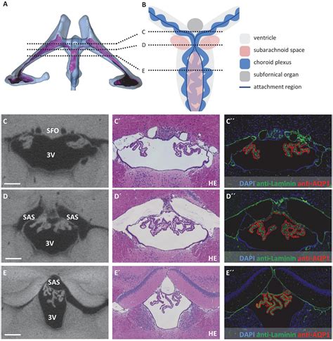 Frontiers Morphology Of The Murine Choroid Plexus Attachment Regions