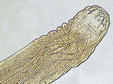 Larva Migrans Cut Nea Bicho Geogr Fico Epidemiologia Diagn Stico E