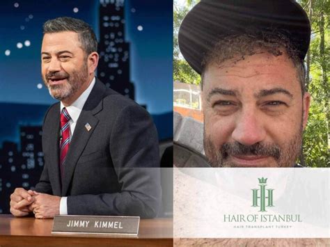 Jimmy Kimmel Hair Transplant Insights into His New Look