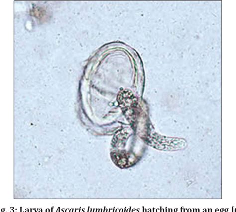 Ascaris Lumbricoides Epidemiology Diagnosis Treatment And Control Semantic Scholar