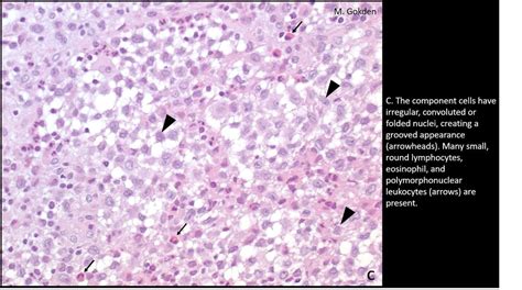 Langerhans Cells Histology