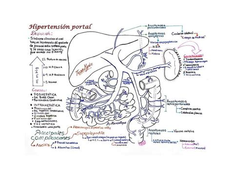 Hipertensión Portal Apuntes de medicina uDocz