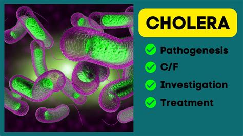 Cholera Vibrio Cholerae Pathophysiologyclinical Featuresinvestigationtreatment Youtube