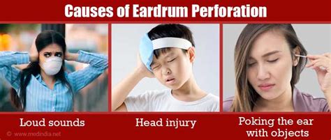 Causes, Symptoms and Signs of Eardrum Perforation