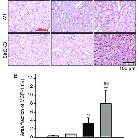 Effects Of Sirt On Cisplatin Induced Neutrophil Infiltration A