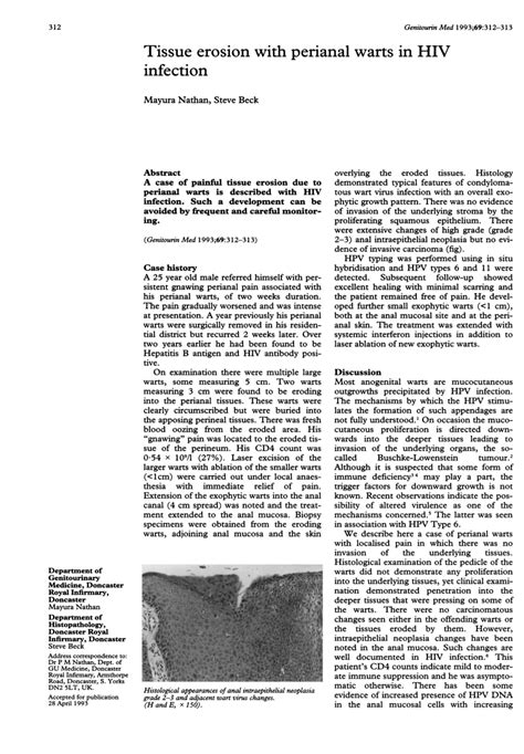 Pdf Tissue Erosion With Perianal Warts In Hiv Infection