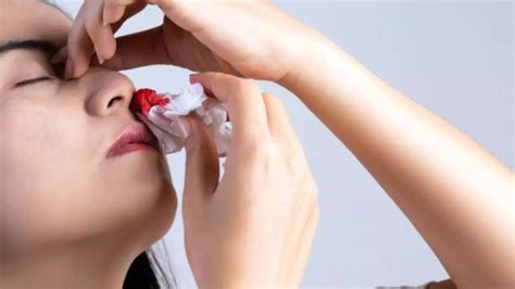 Nose Bleeding In Summer Cause Treatment Remedies Know Home Remedies