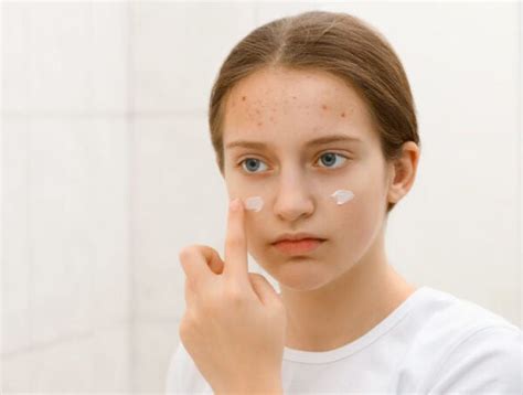 Beat The Breakouts 3 Amazing Benefits Of Dermatology Ingredients For