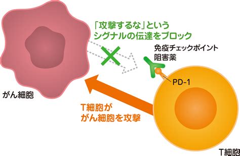 肝細胞がんhccの主な治療法 患者の皆様 武田薬品工業株式会社