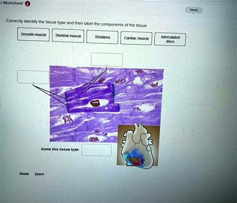 Solved Correctly Identify The Tissue Type And Then Label The