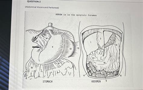 Solved Abdominal Viscera And Peritoneal ARROW Is In The Chegg