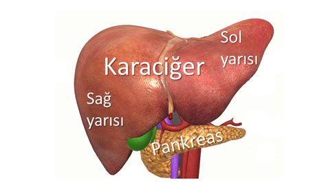 Klatskin Tümörü Kolanjiyokarsinom Safra Yolu Kanseri