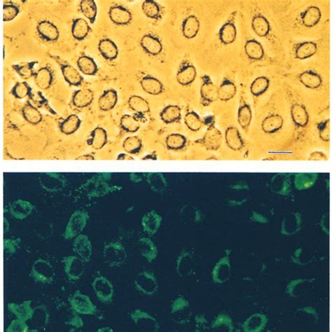 Endothelial Cell Characterization A Phase Contrast Photomicrograph Download Scientific