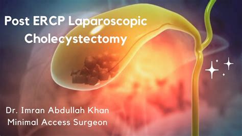 Post Ercp Laparoscopic Cholecystectomy Difficult Calot S Wide Cystic Duct Dr Imran Abdullah