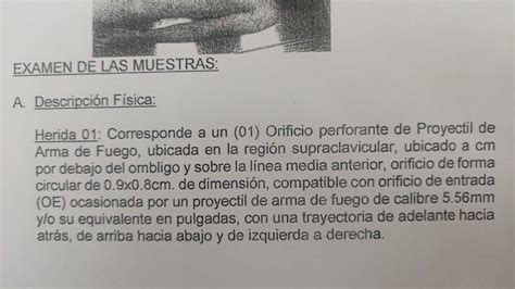 Ángel Páez On Twitter Contundentes Peritajes Balísticos Practicados A