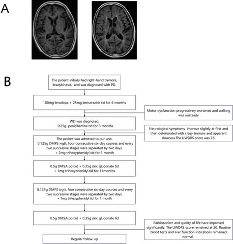 Parkinsonism Related Disorders