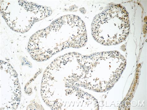 Bdnf Antibody Ap Proteintech