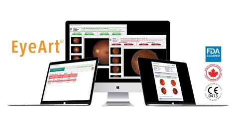 Eyenuk S Autonomous Ai For Diabetic Retinopathy Screening Wins Fda Nod Medical Product Outsourcing