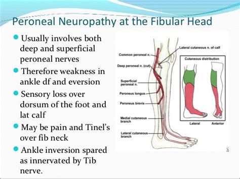 Peripheral Nerve Entrapment