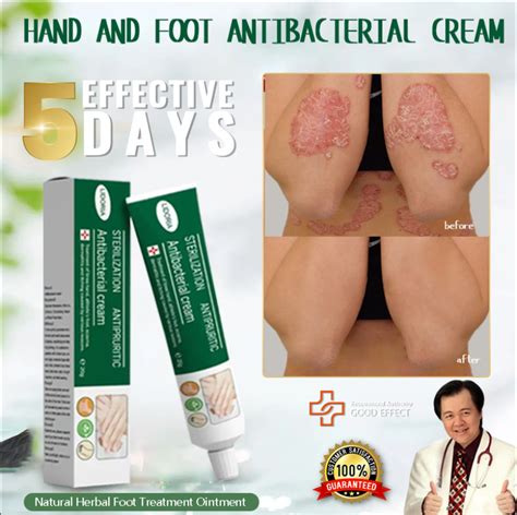 Atoderma Cream Original Gamot Sa Kati Kati Sa Balat Eczema Psoriasis