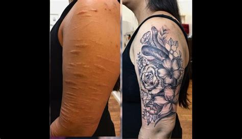 Tatuajes para tapar cicatrices 10 increíbles diseños para esconder