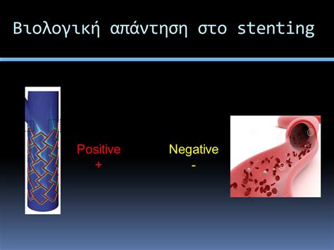 Θεματική ενότητα Stenting Γ Κούβελος Md Msc Phd Clinical And