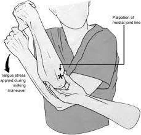 Little Leaguer's Elbow - ATBA