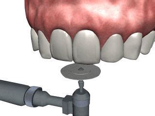 Dental Surgery Software Na Navadha Enterprises Periodontal