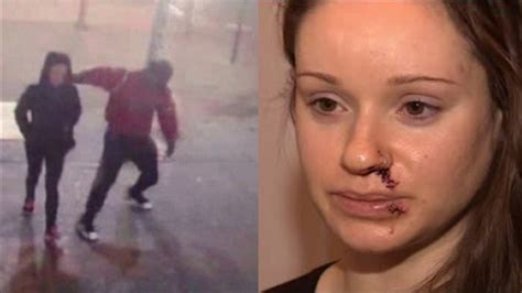 Brooklyn Woman Slashed In Face By Stranger In Chelsea No Arrests Made