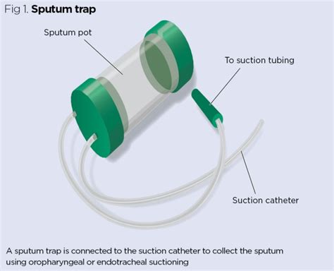 Instructions For Collecting Sputum For Tuberculosis Tb