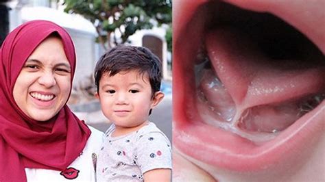 Nostlagia Tumbuh Kembang Anak Nycta Gina Sempat Kurang Berat Badan