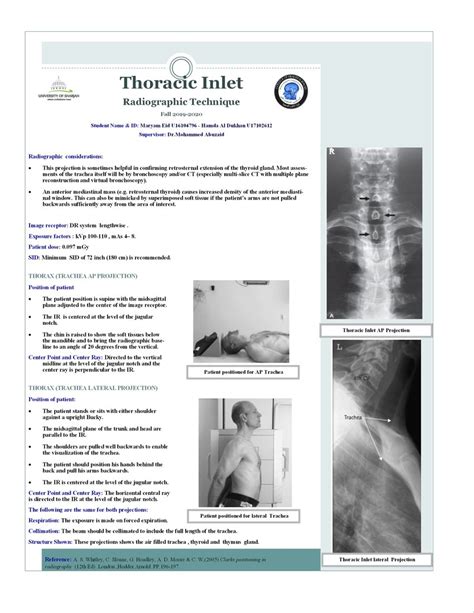 Thoracic Inlet Diagram