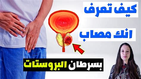 علامات سرطان البروستاتا كيف تعرف انك مصاب بسرطان البروستات ؟ Youtube