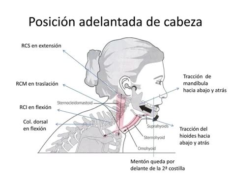 Forward Head What Is It Symptoms And Causes